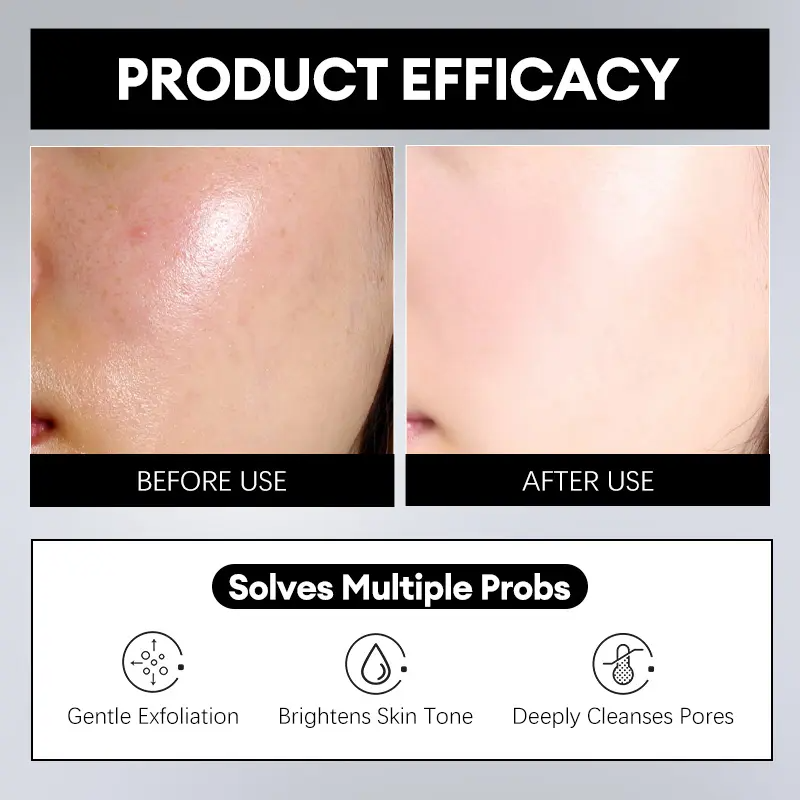 Exfoliating Peeling Serum