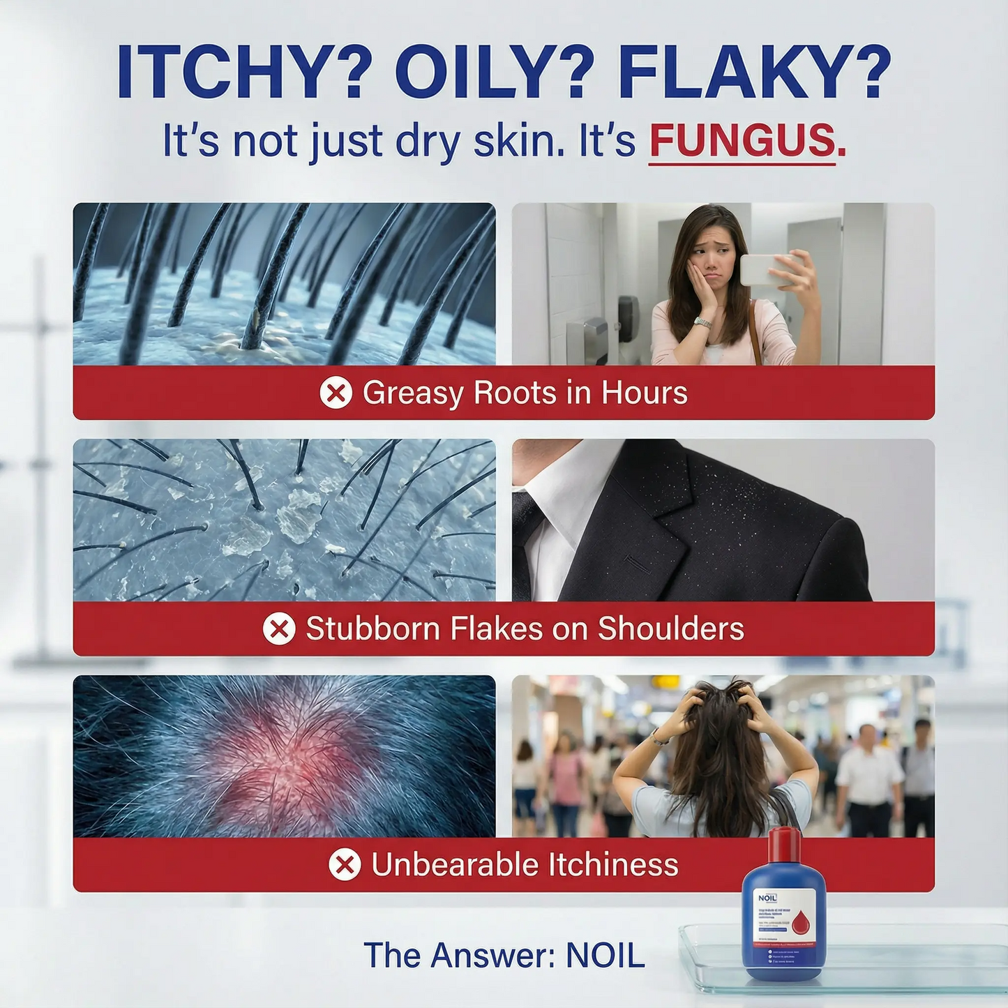 Selenium Disulfide Anti-Dandruff Shampoo