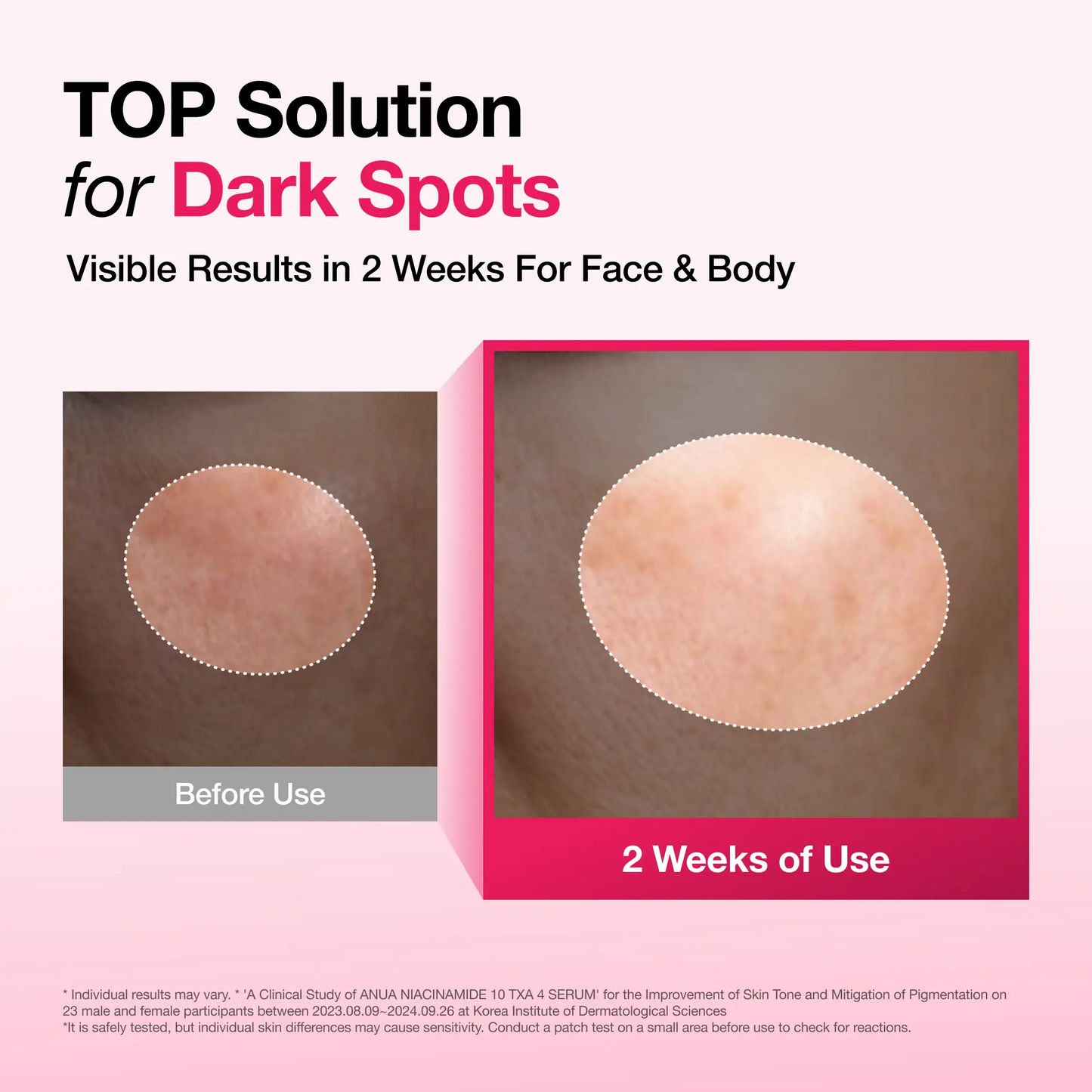 Dark Spot Correcting Serum