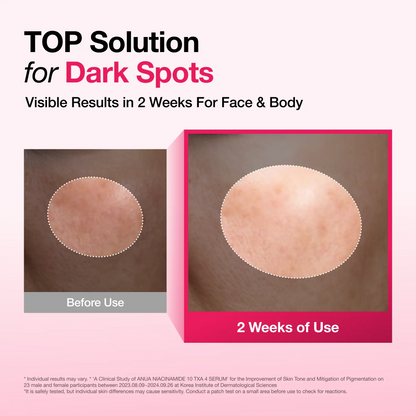 Dark Spot Correcting Serum
